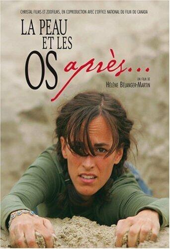 La Peau et les os... après (Version française)